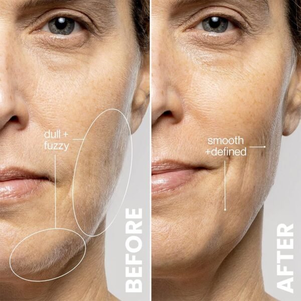 Electric Dermaplaning Tool for Face - Professional Exfoliation and Peach Fuzz Removal | Painless Facial Hair Remover for Smooth, Radiant Skin - Image 5
