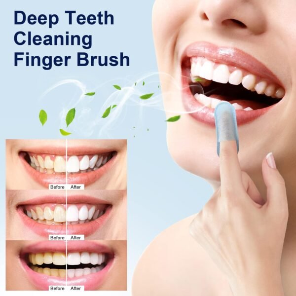 MySmile 100pcs Teeth Wipes Disposal Finger Brush Deep Cleaning Teeth Wipes Oral Brush Up Tooth Wipes ​for Teeth Cleaning, Mint Flavor - Image 4
