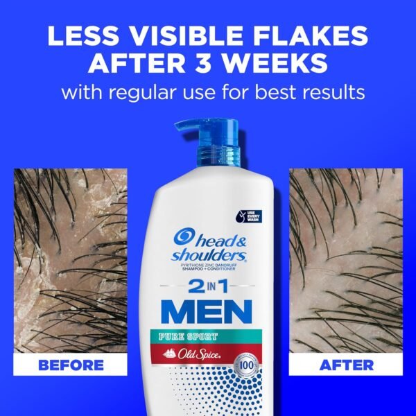 Head & Shoulders 2-in-1 Dandruff Shampoo and Conditioner Set, Clinically Proven Dandruff & Itch Relief, Lemon-Lime Scent of Old Spice Pure Sport, Nourish Scalp & Hair, 31.4 Fl Oz Each, 2 Pack - Image 5
