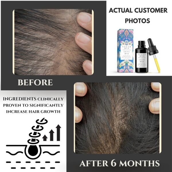USDA Organic Rosemary Hair Growth Treatment with Castor, Jojoba & Rosemary Oils - Scalp Nourishment for Healthier, Thicker & Shiny Hair, 1 fl oz - Image 7