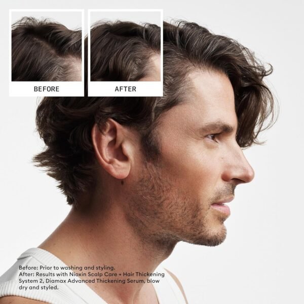 Nioxin Scalp + Hair Thickening System 2 Shampoo- For Natural or Untreated Hair with Progressed Thinning - With Niacinamide and Biotin - Image 7