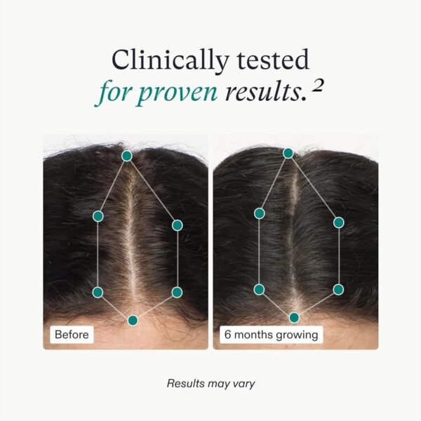 Nutrafol Women's Hair Growth Supplements, Ages 18-44, Clinically Proven for Visibly Thicker and Stronger Hair, Dermatologist Recommended - 1 Month Supply - Image 9